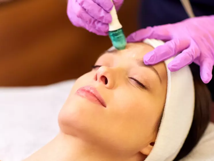 MICROAGULHAMENTO FACIAL MICROAGULHAMENTO FACIAL